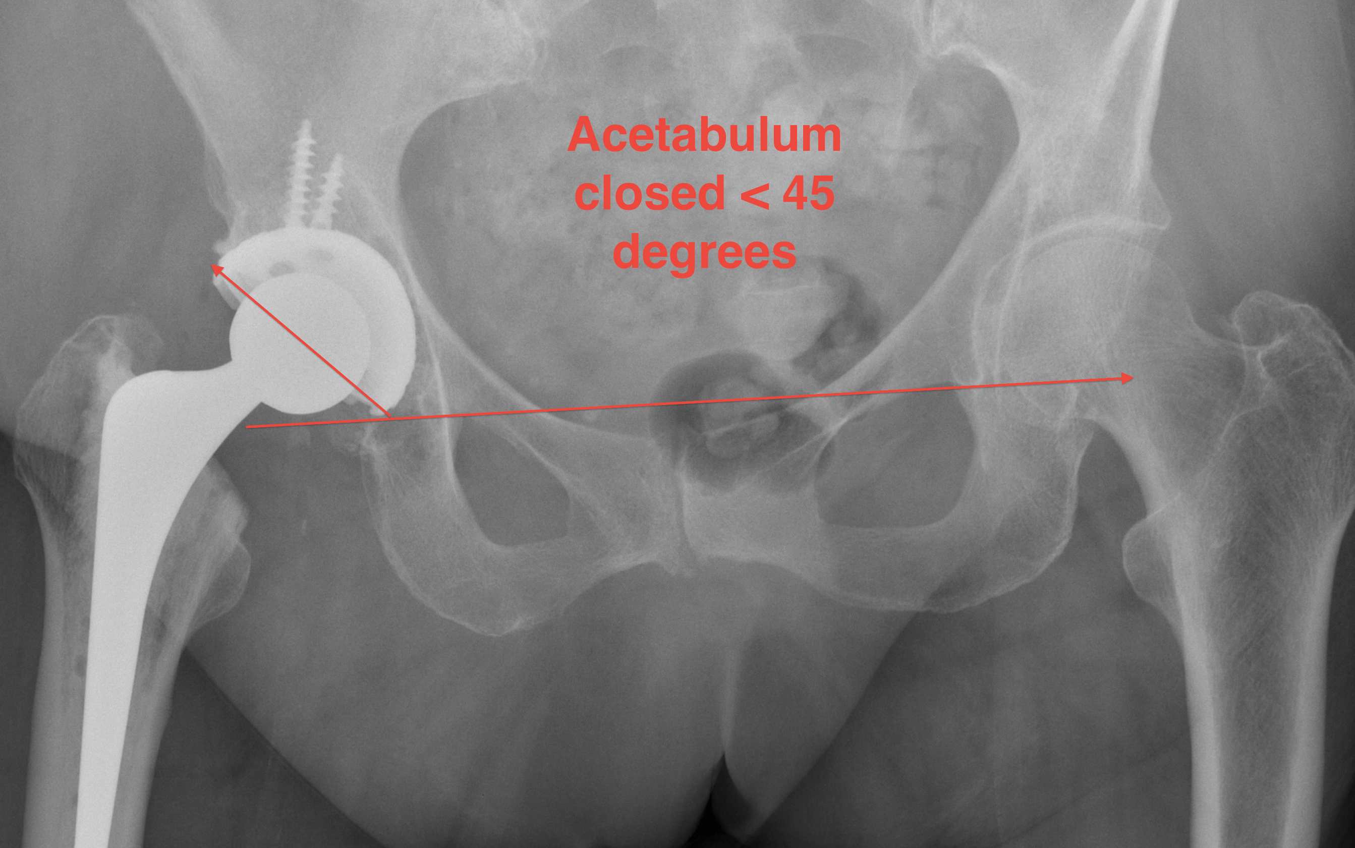 Dislocation  The Bone School