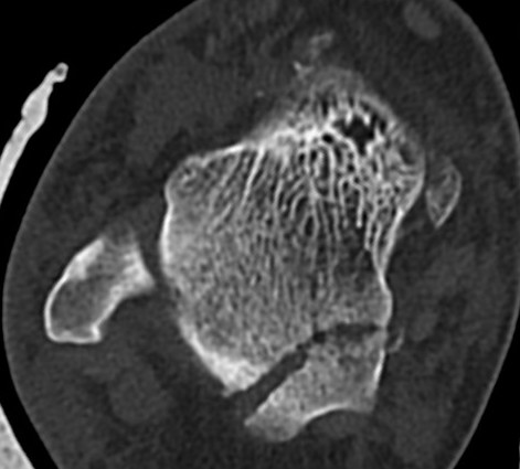 Posterior process