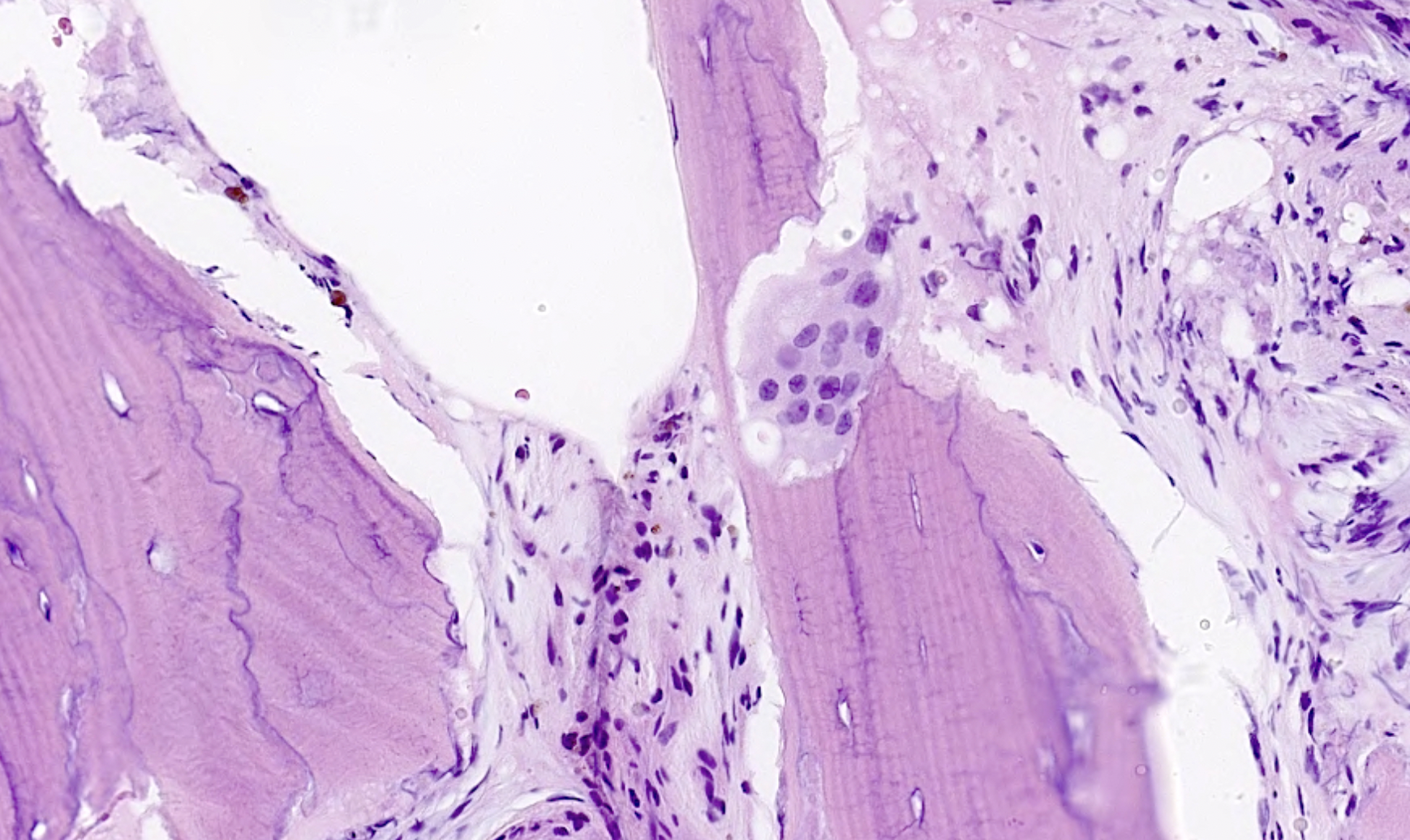 Pagets histology